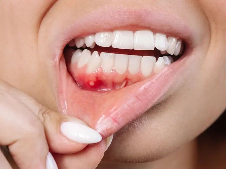 Overview of Common Gum Disease Symptoms and Treatment Methods